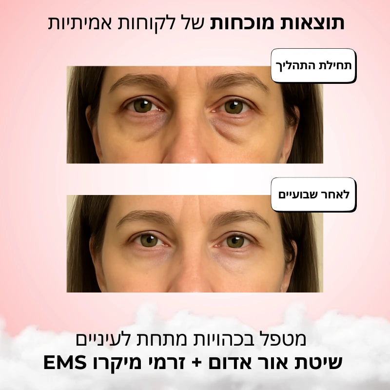 ערכת טיפול ביתית מתקדמת למראה צעיר ורענן
